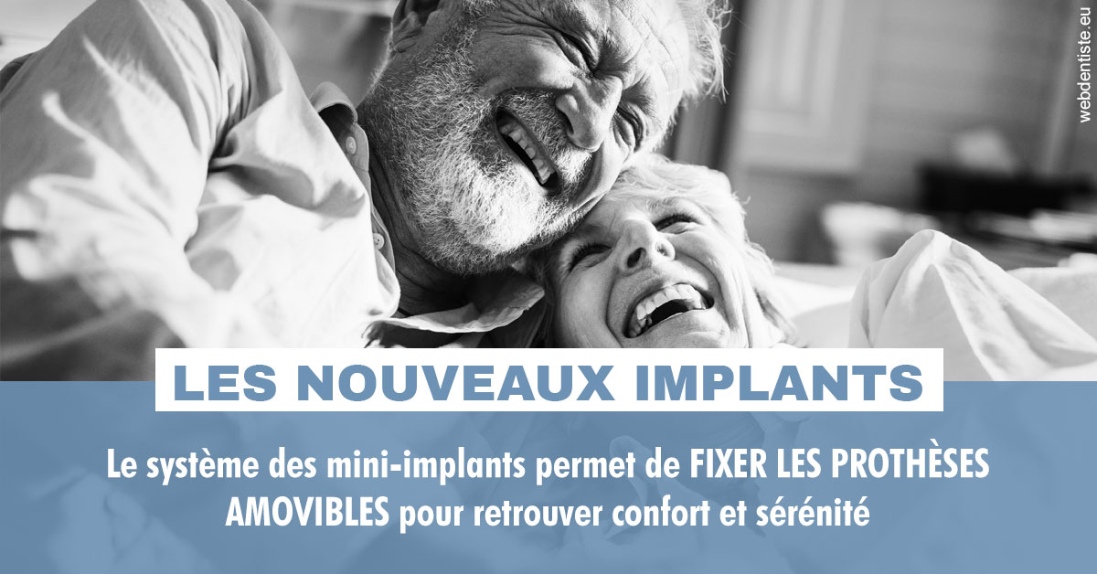 https://scp-jacques-et-elisabeth-topin.chirurgiens-dentistes.fr/Les nouveaux implants 2