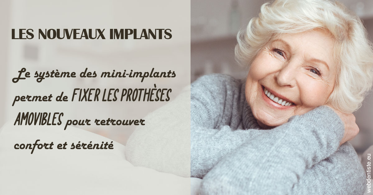 https://scp-jacques-et-elisabeth-topin.chirurgiens-dentistes.fr/Les nouveaux implants 1