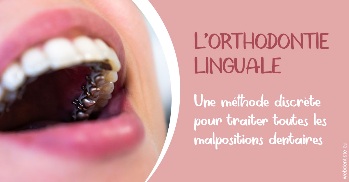 https://scp-jacques-et-elisabeth-topin.chirurgiens-dentistes.fr/L'orthodontie linguale 2
