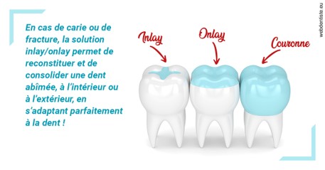 https://scp-jacques-et-elisabeth-topin.chirurgiens-dentistes.fr/L'INLAY ou l'ONLAY
