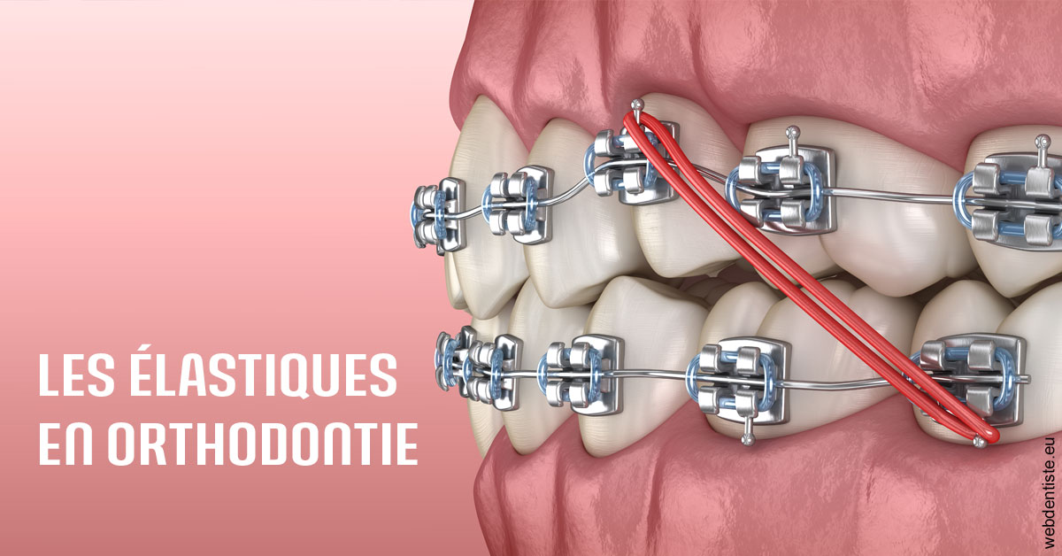 https://scp-jacques-et-elisabeth-topin.chirurgiens-dentistes.fr/Elastiques orthodontie 2