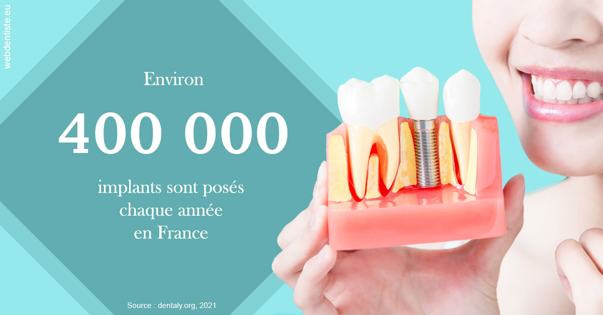 https://scp-jacques-et-elisabeth-topin.chirurgiens-dentistes.fr/Pose d'implants en France 2